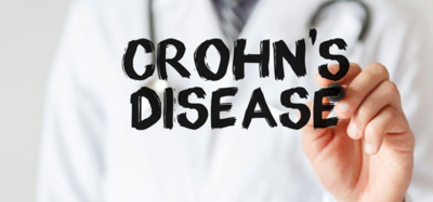 Farmaci, Ue approva ampliamento indicazione mirikizumab in malattia di Crohn