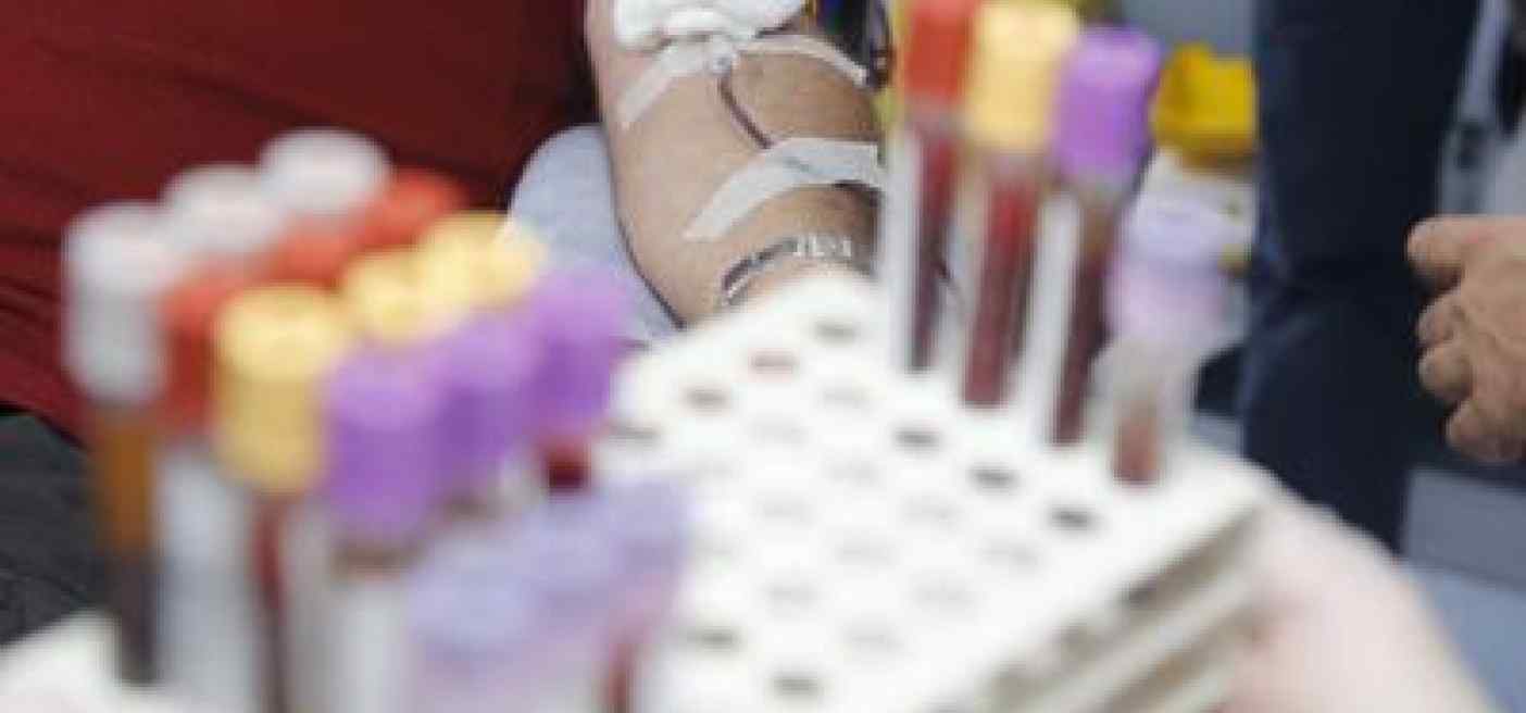 Egpa, l'esperto: "Diagnosi difficile ma con anti Il-5 ottimi risultati"