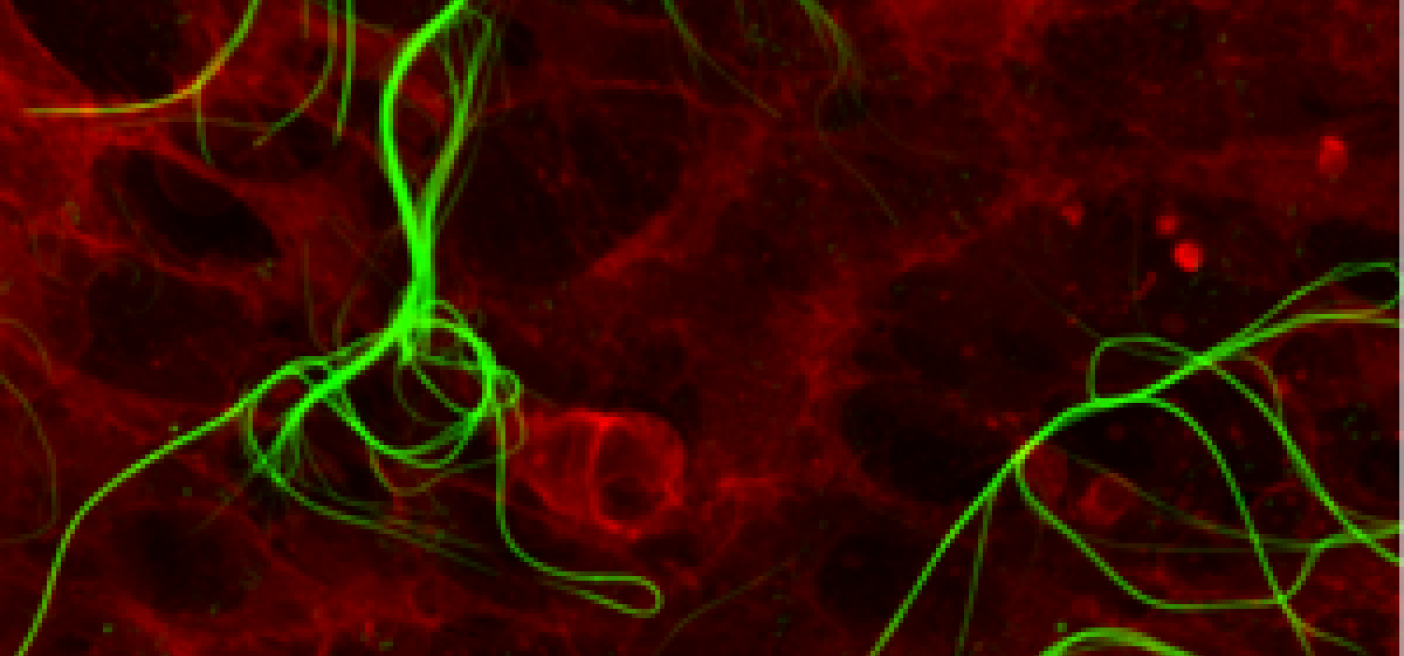 Molecola latte mamma potenzia cervello, allo studio per invecchiamento