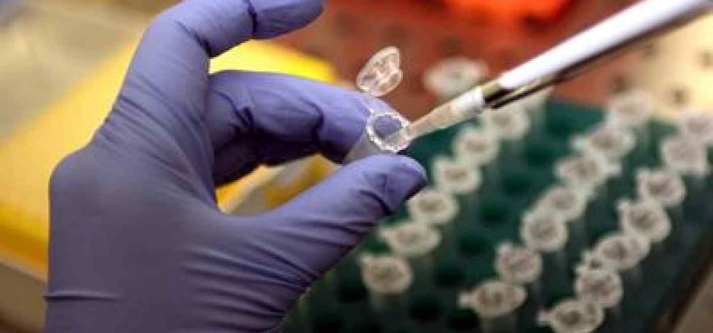 Tumori, da scienziati UniMi studio in vivo su come migrano cellule cancro