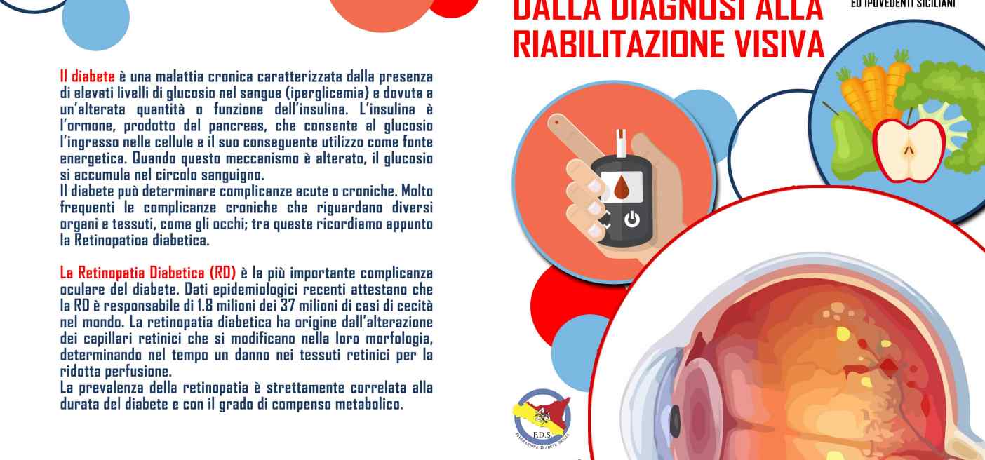 convegno retinopatia diabetica il 28 giugno al Cervello