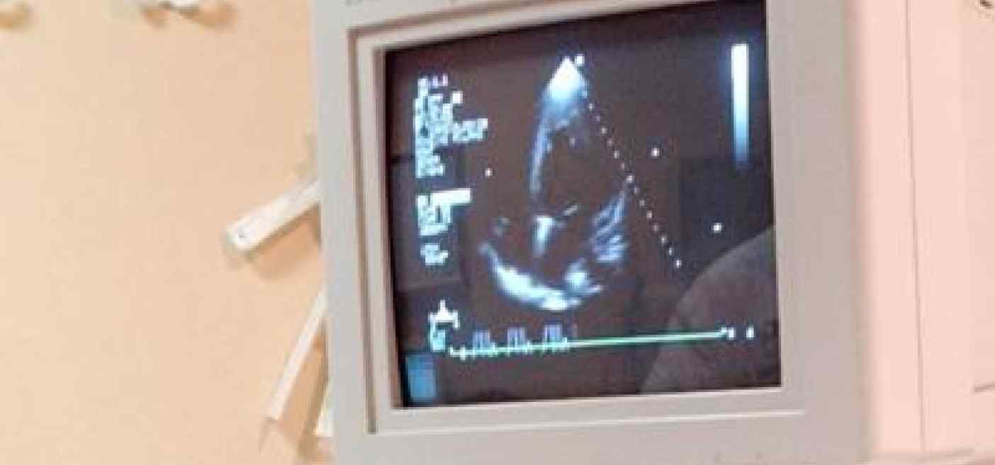 Giornata del cuore, cardiologi lanciano primo Piano strategico nazionale