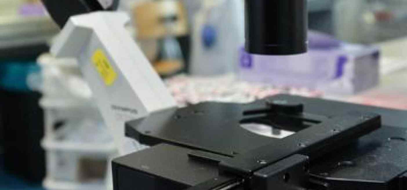 Cancro, svelato nuovo bersaglio per combattere tumore della colecisti
