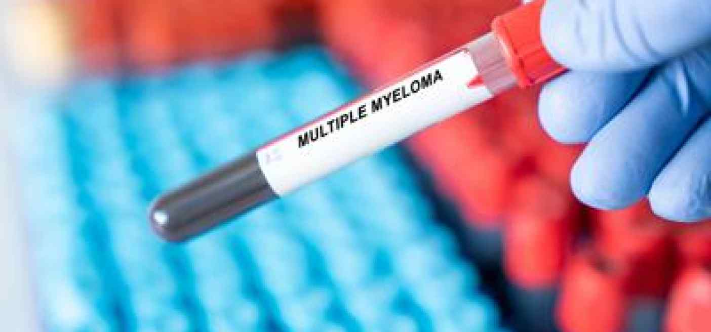 Mieloma multiplo, ok dell'Ue a Isatuximab per pazienti non eleggibili a trapianto