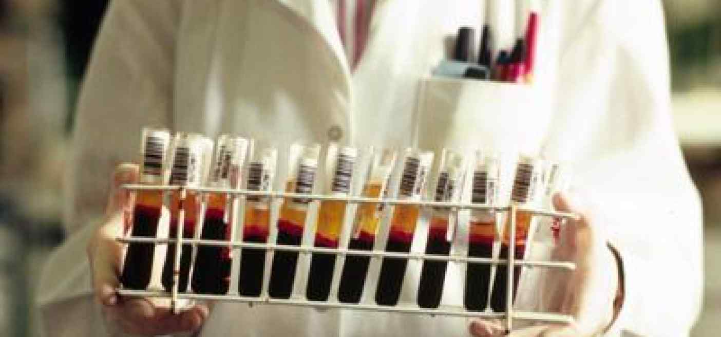 Egpa, il reumatologo: "Con monoclonali remissione in oltre 90% casi"