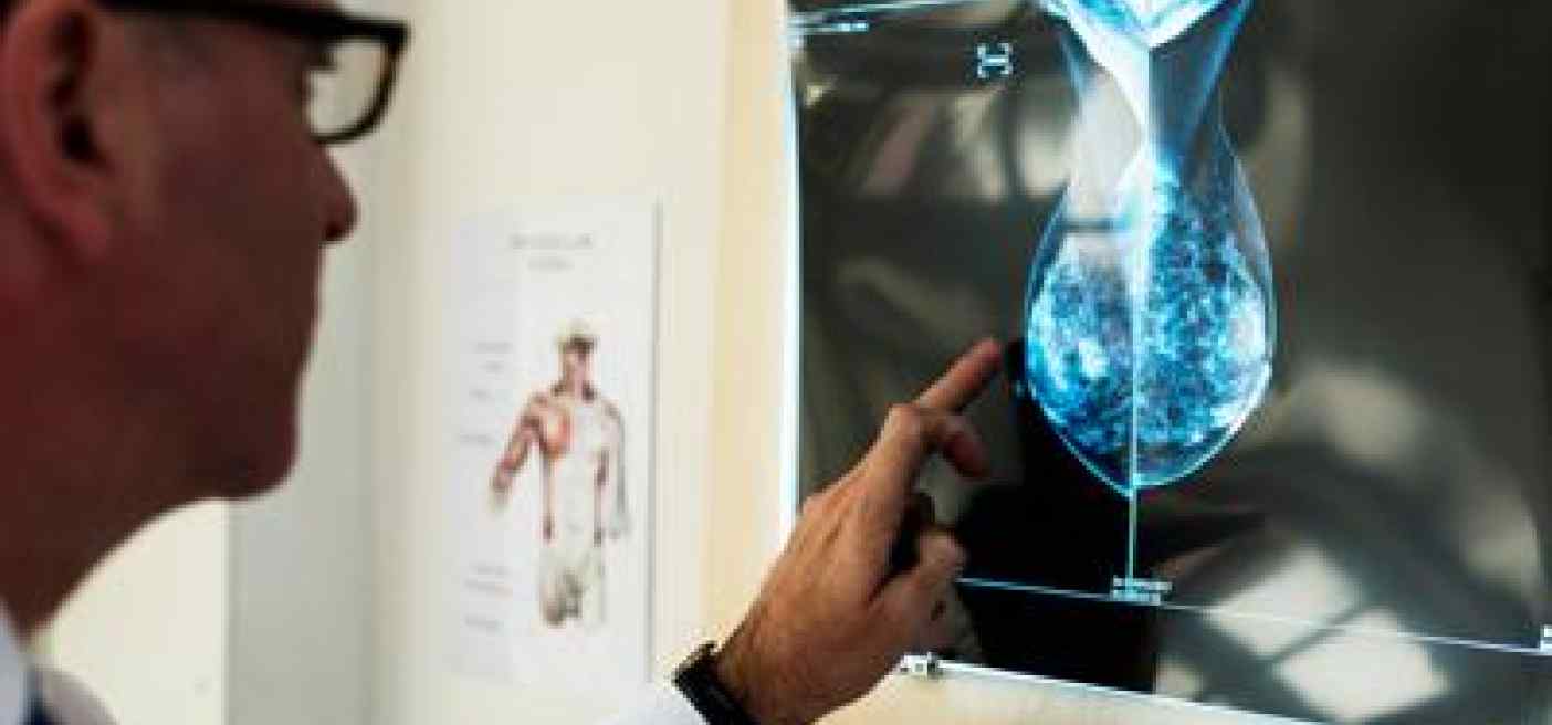Cancro al seno, crioablazione nuova frontiera di cura