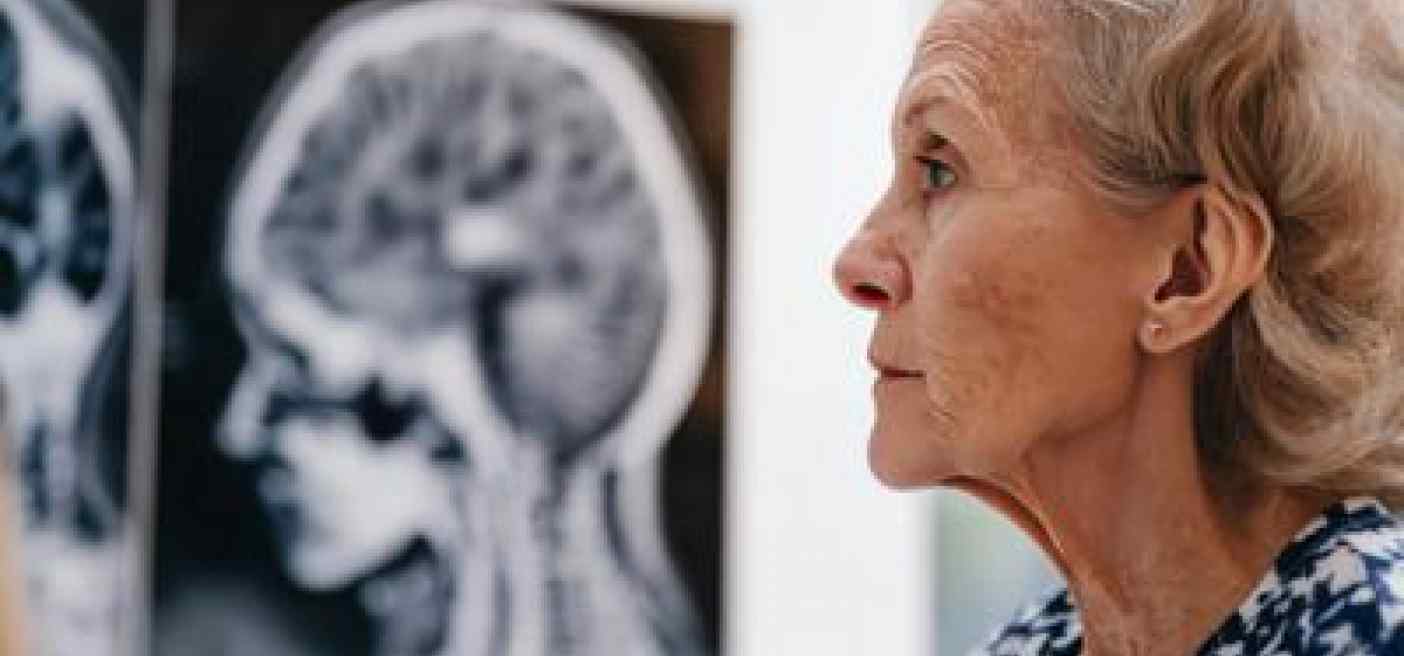 Giornata salute donne, Sin 'prendetevi cura anche della salute neurologica'