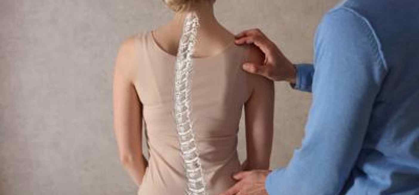 Scoliosi dell'adulto, tutte le novità dai trattamenti alla chirurgia
