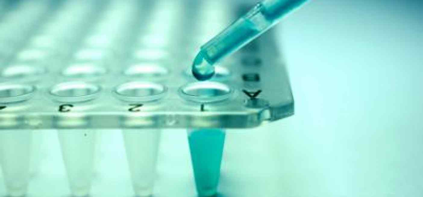 Medici cinesi, 'curato diabete 2 in 59enne con trapianto cellule pancreas'