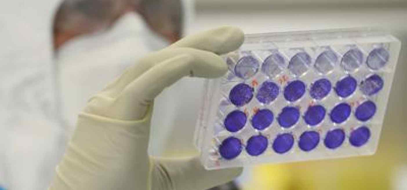 Oms, Hpv ad alto rischio per 1 maschio 'over 15' su 5
